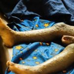 RDC : Ebola franchit la barre des 8 900 cas confirmés, le bilan continue de s’alourdir